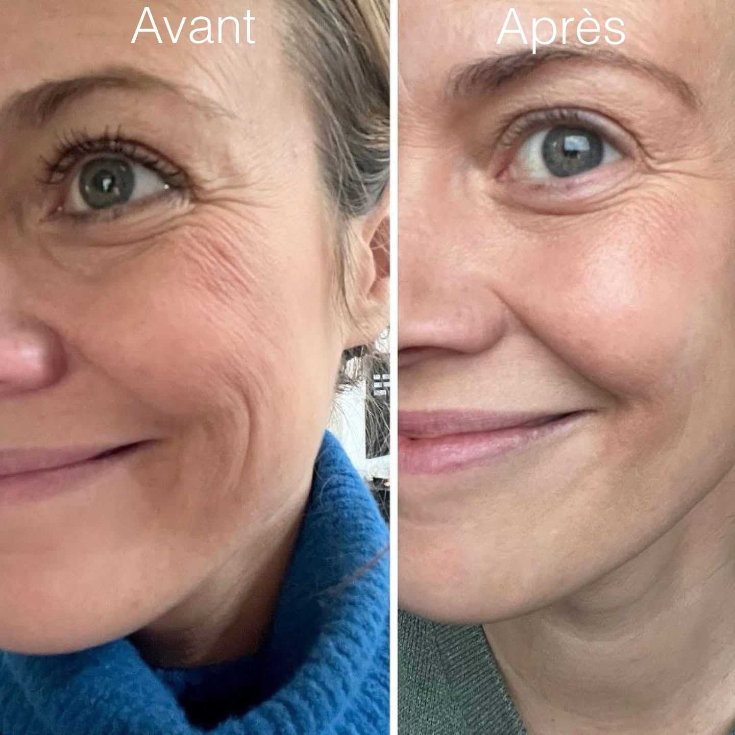 Résultats visibles